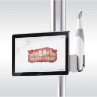 Studio Dentistico Belvedere - Servizi - Impronte digitali