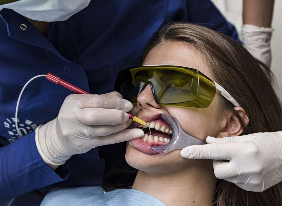 Studio Dentistico Belvedere - Casi clinici - Trattamento laser gengivale