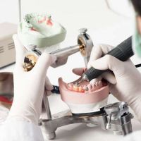 Studio Dentistico Belvedere - Servizi - Protesi