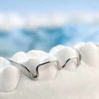 Studio Dentistico Belvedere - Servizi - Ortodonzia e Invisalign